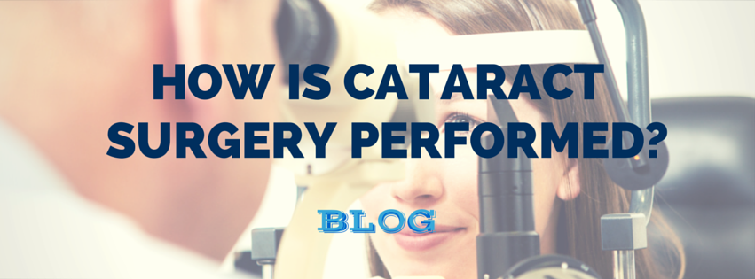How is Cataract Surgery Performed? post thumbnail image
