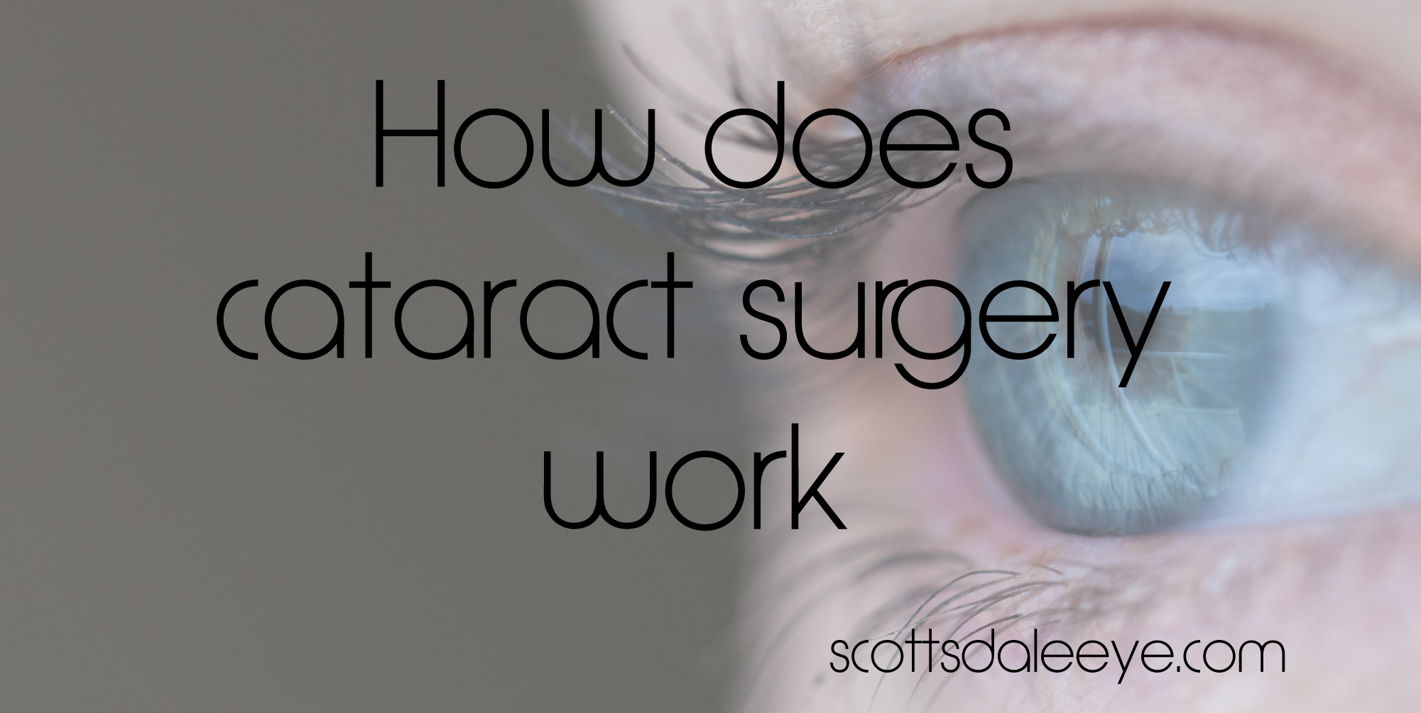 How does cataract surgery work?