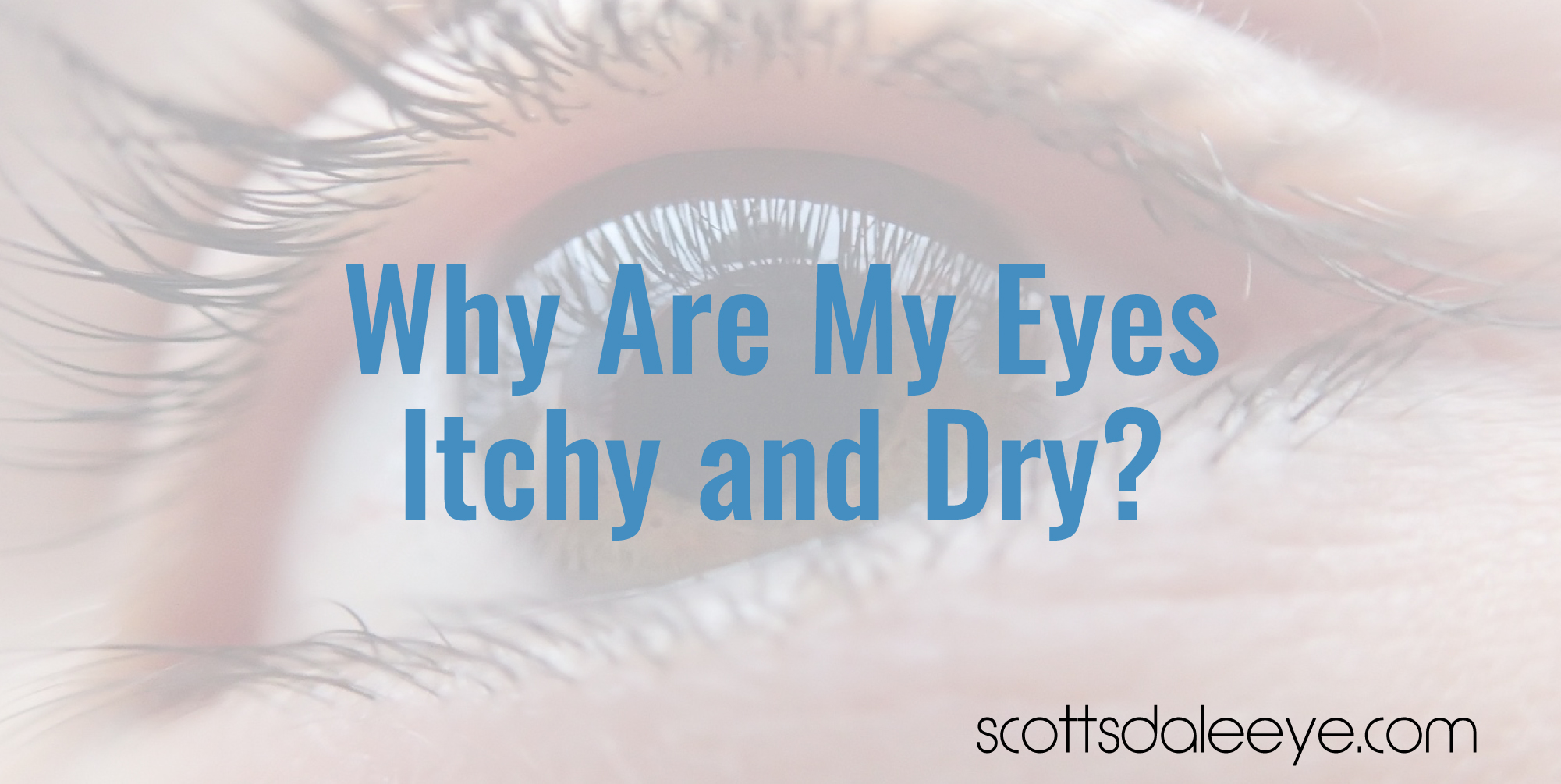 Why Are My Eyes Itchy and Dry?
