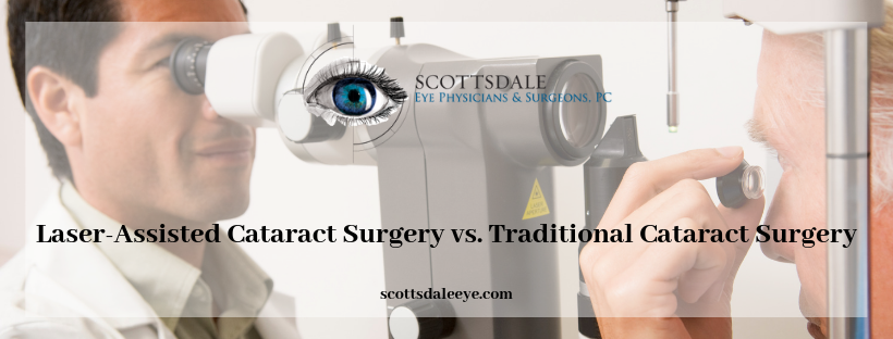 Can Laser-Assisted Cataract Surgery be Beneficial? post thumbnail image