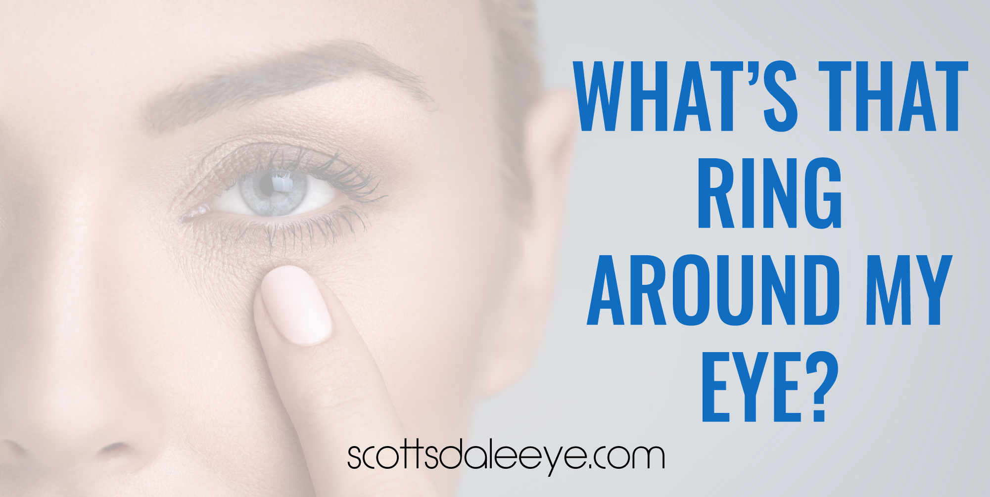 Around my eyes. Two Rings around Eyes from Sun. Two White Rings around Eyes from Sun. Two White Rings around Eyes.
