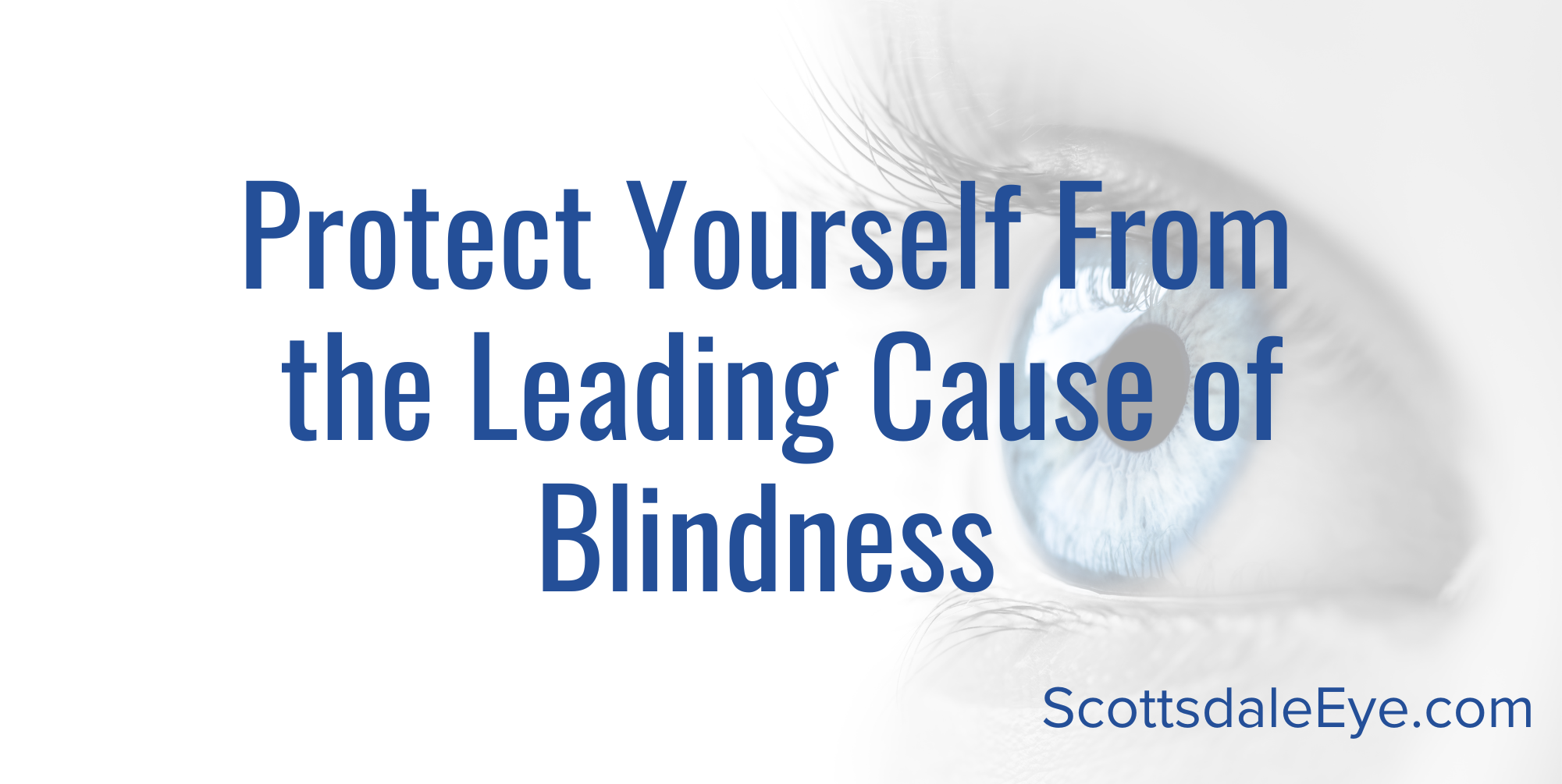 5 Tips for Preventing Age-Related Macular Degeneration post thumbnail image