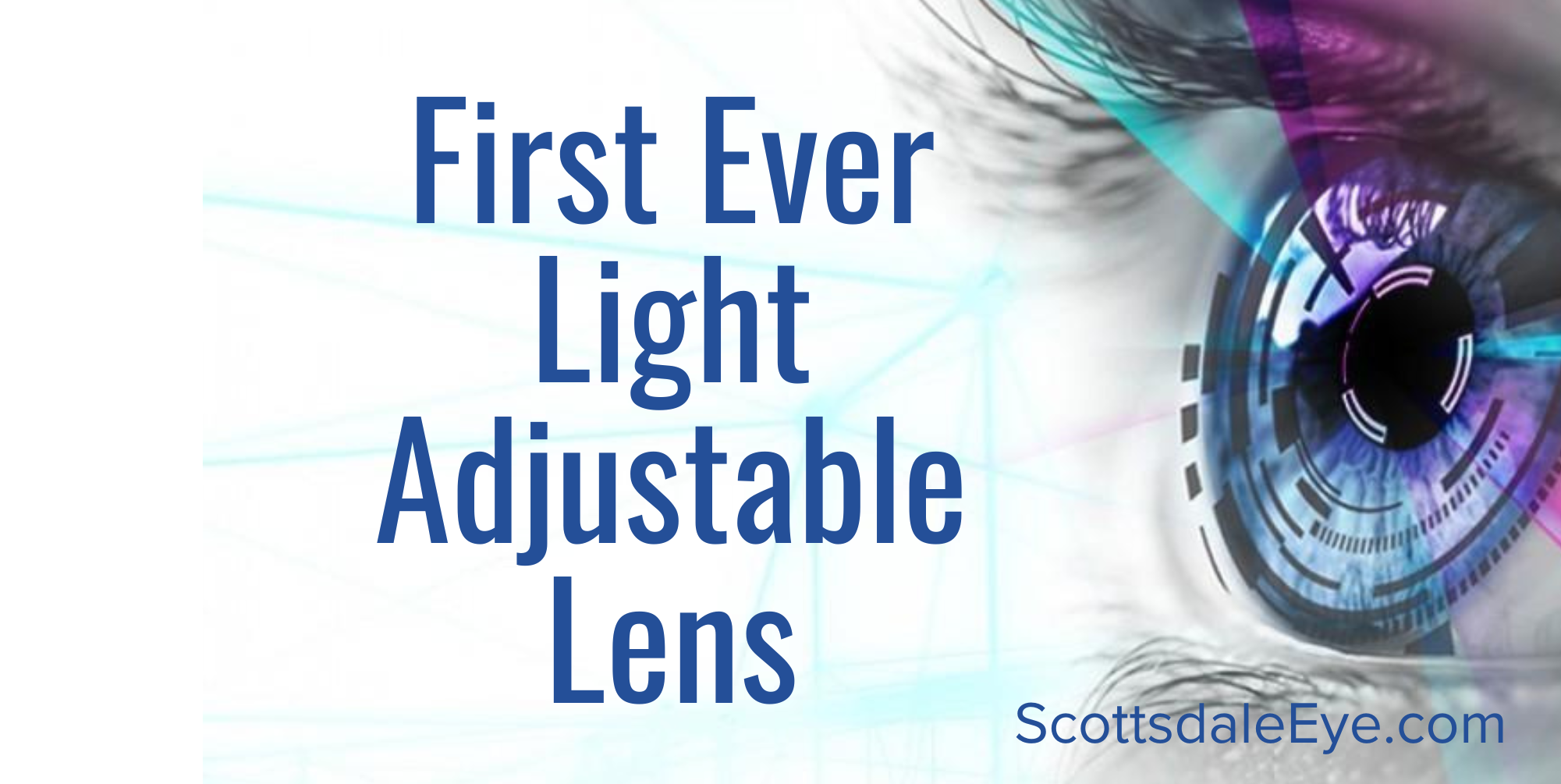 Revolutionizing Vision Correction: The Light-Adjustable Lens post thumbnail image